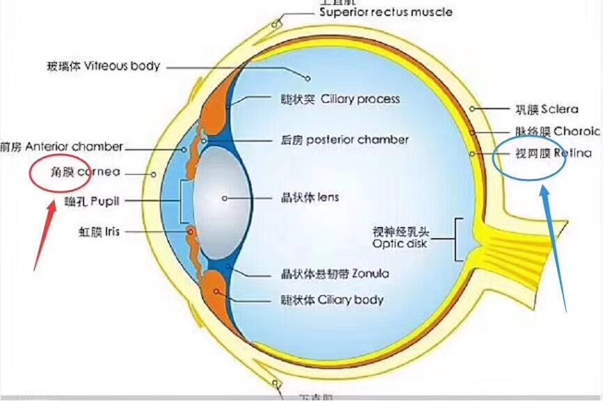 十多年过去了，第一批激光治疗近视的人是否有出现不良反应？-1.jpg